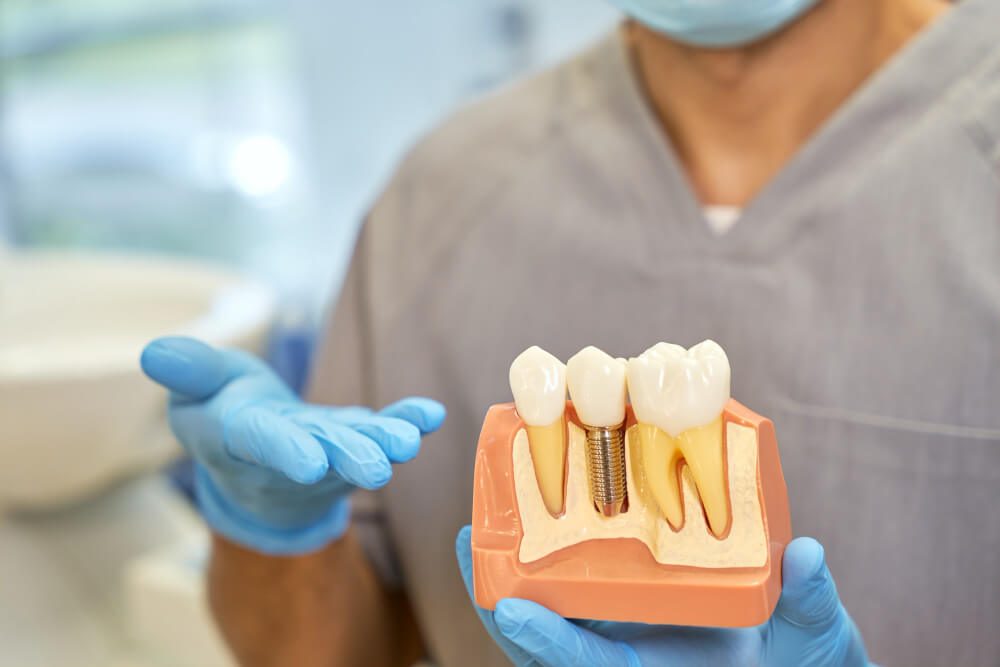 dental implants cheltenham benefits and advantages