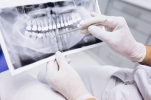 Dental X-rays Moorabbin