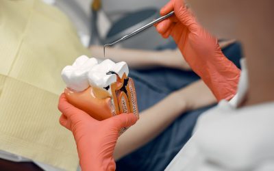 Dental Tips: Signs That You Need Root Canal Treatment