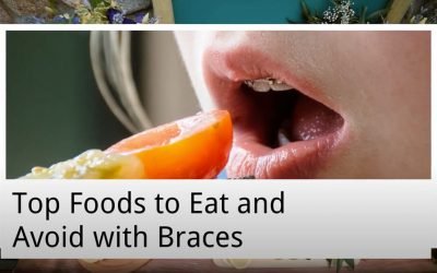 Top Foods to Eat and Avoid with Braces from Captivate Dental