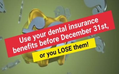 Dental Insurance Benefits: Use it or Lose it! | Captivate Dental
