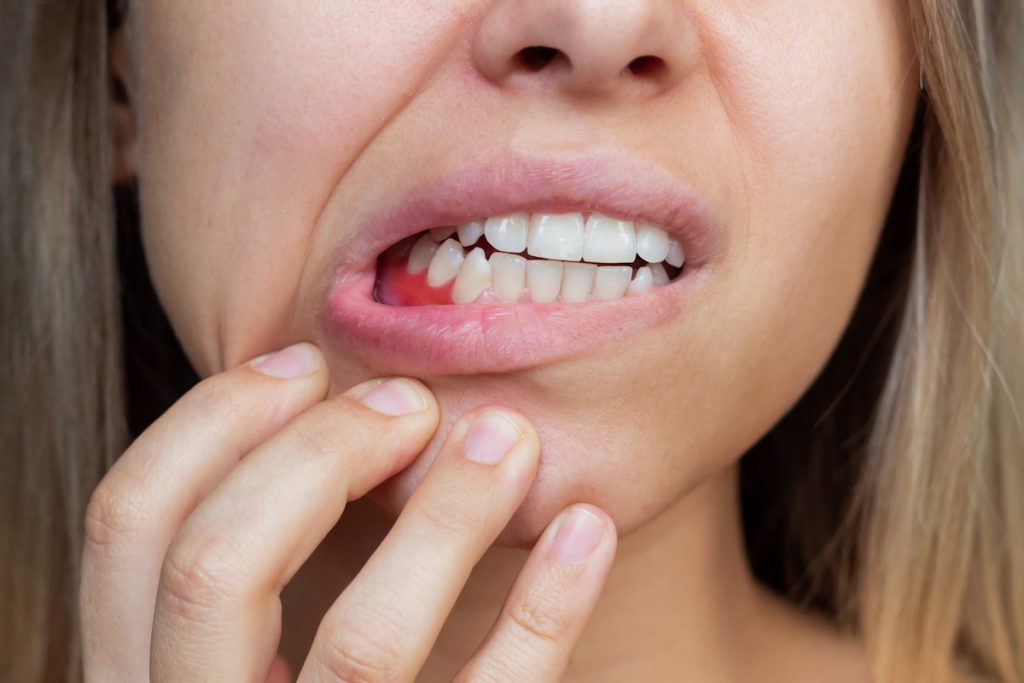 top 10 reasons for bleeding gums captivate dental dentist moorabbin
