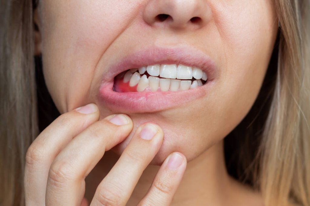 8 symptoms of gingivitis and how to prevent them