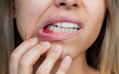 8 Symptoms Of Gingivitis And How to Prevent Them