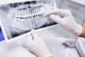 Dental-X-rays-Cheltenham