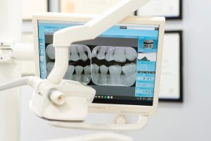 captivate-dental-planmeca-romexis-dentist-cheltenham