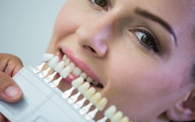 Porcelain Veneers vs Crowns: Which is Best for Your Smile?