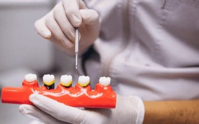 Dental Crown Cost: What Affects the Price and What to Expect