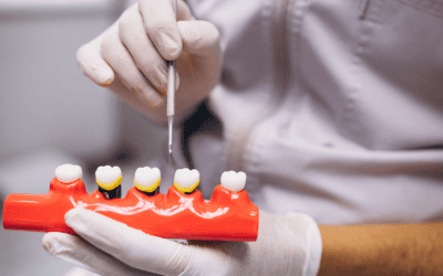 Dental Crown Cost: What Affects the Price and What to Expect